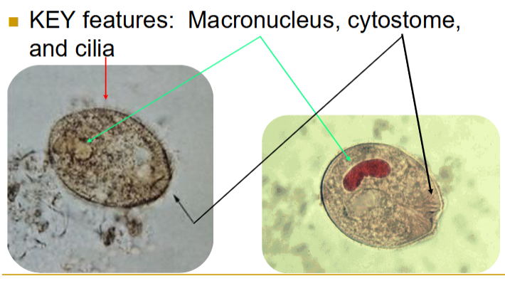 <ul><li><p>50-100u</p></li><li><p>key features: macronucleus, cytostome, and <strong><u>cilia</u></strong></p></li><li><p>also has a micronucleus; very hard to find </p></li></ul><p></p>