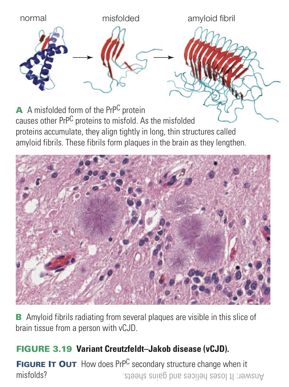 <p>Infectious protein that causes other normally folded proteins to misfold too.</p>