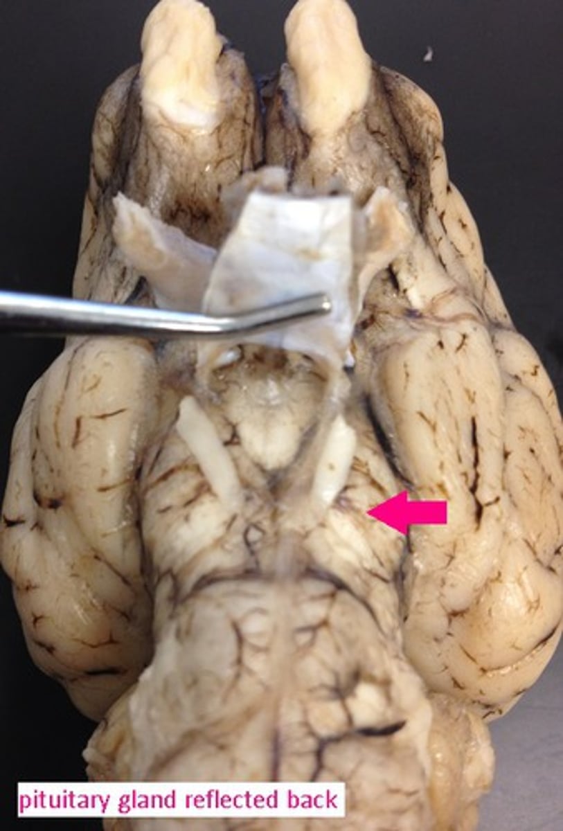 <p>Identify the structure.</p>
