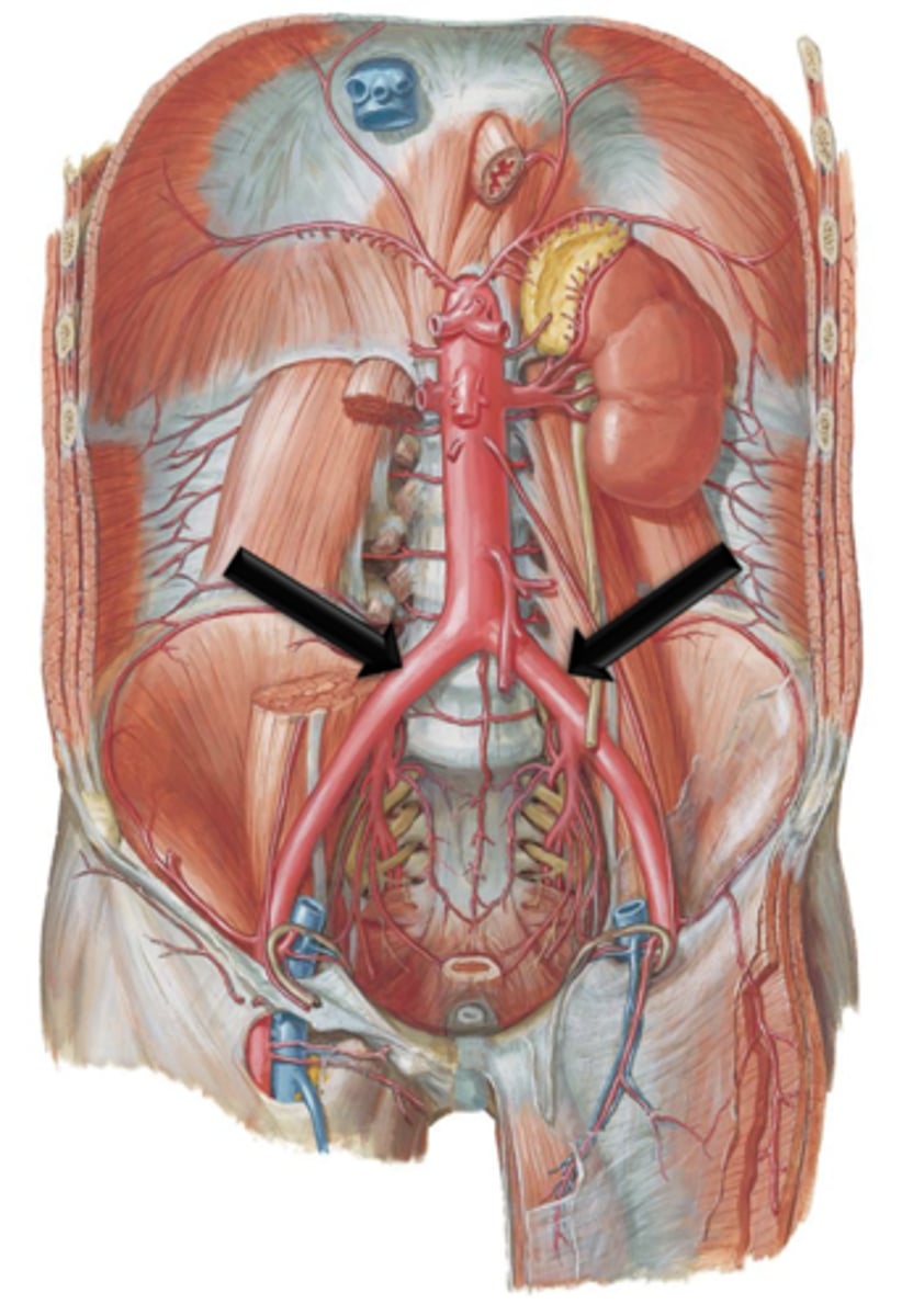 <p>The common iliac arteries course for approximately 5 centimeters before bifurcating into what?</p>