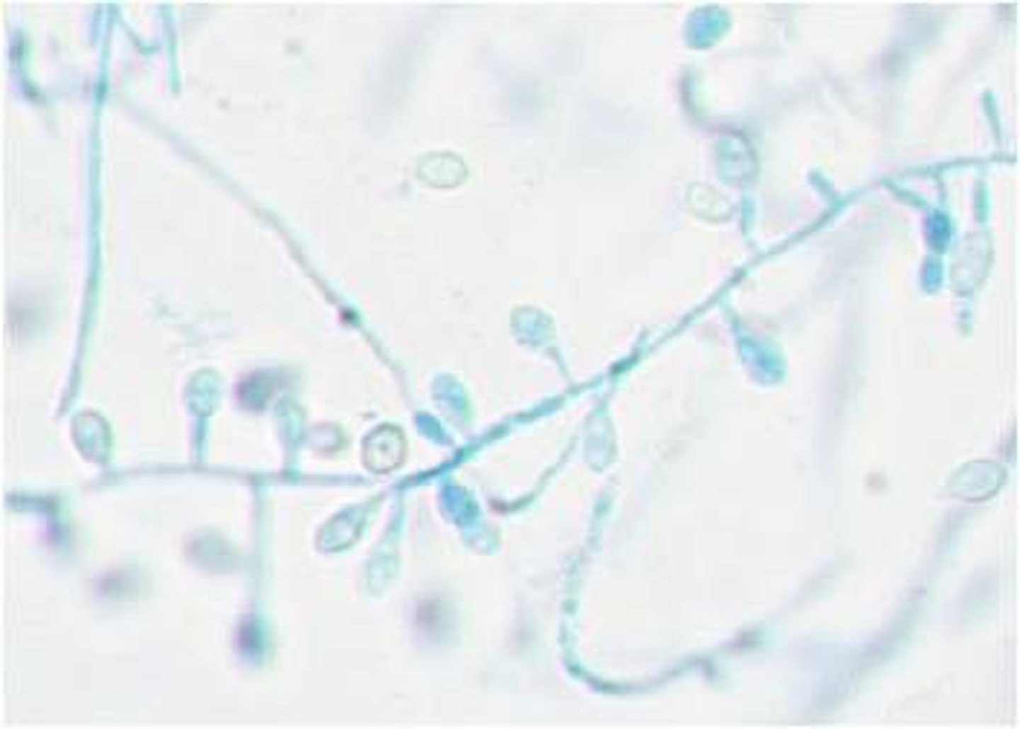 <p>rapid; 2-3 days</p><p>Heaped, velvety, buff color</p><p>Reverse: white, yellow or brown</p><p>Microscopic: single, clubbed conidia: may be confused with blasto or histo</p><p>Conditions: n/a usually a contaminant</p>