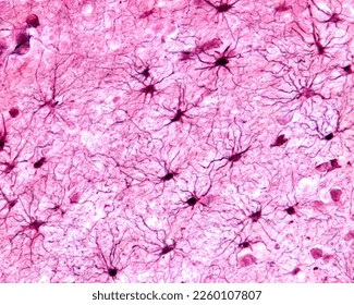 <p>Nerve Tissue</p>