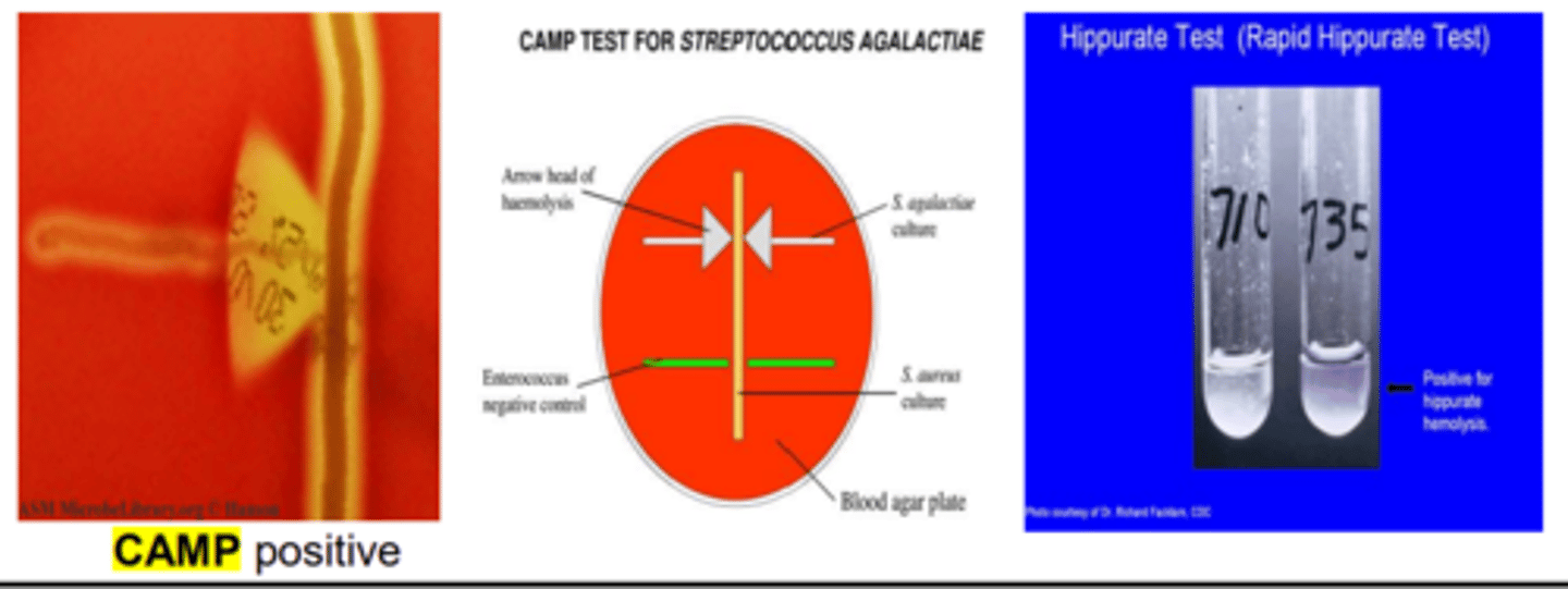 <p>-Gram-positive cocci in chains<br>-Catalase-negative<br>-Bacitracin resistant<br>-Polysaccharide capsule inhibits phagocytosis<br>-CAMP-positive<br>-Hippurate hydrolysis-positive</p>