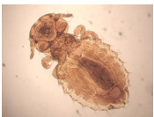 <p>Biting/chewing Lice</p>