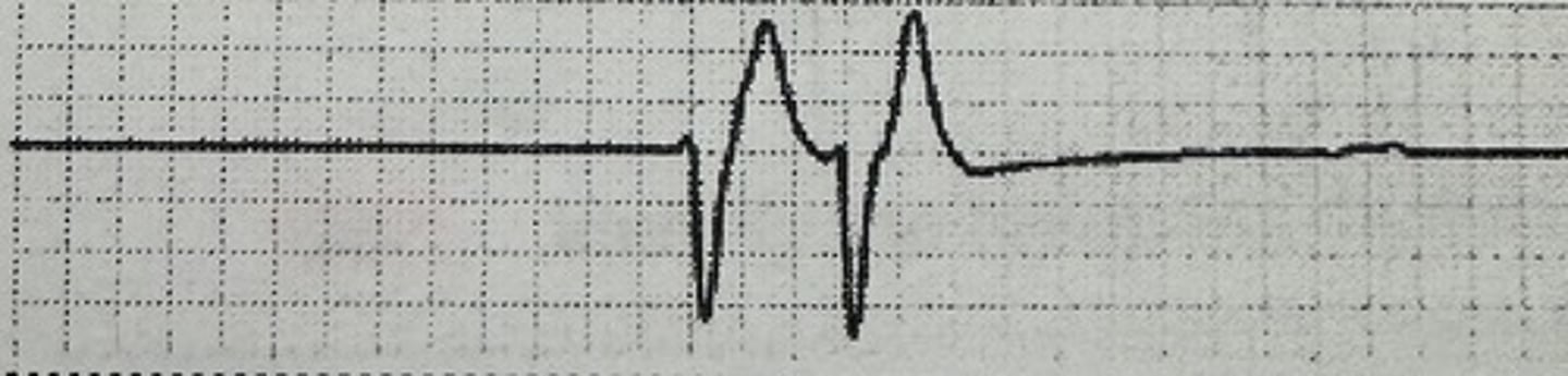 <p>identify the rhythm</p>