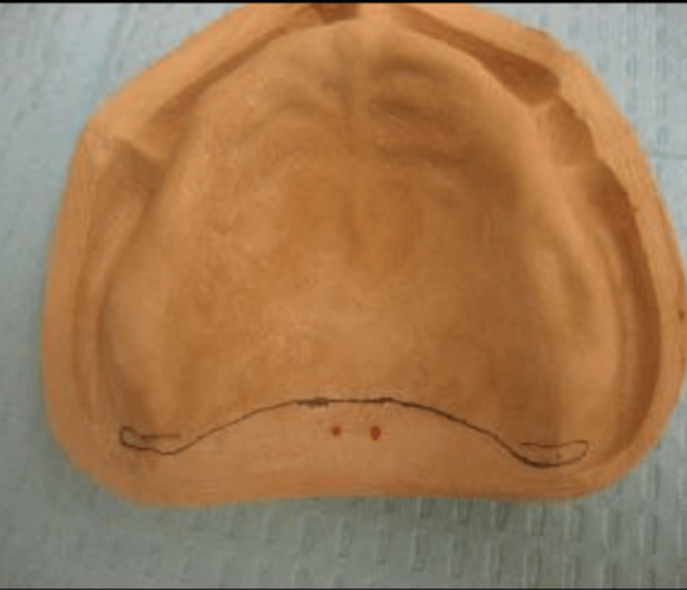 <p>What structure is marked in red and the PPS is placed 5mm anterior to?</p>