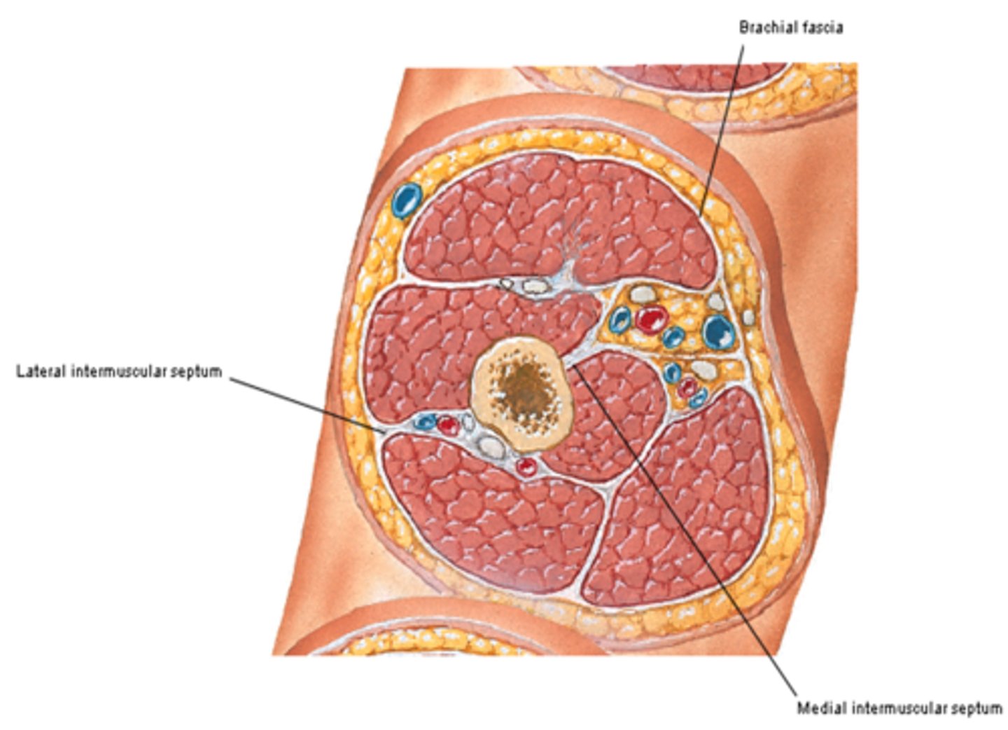 <p>extensions of brachial fascia that attach to the bone, forming fascial compartments that limit spread of infection and hemorrhage in the arm</p><p>-Anterior (flexor) fascial compartment</p><p>-Posterior (extensor) fascial compartment</p>