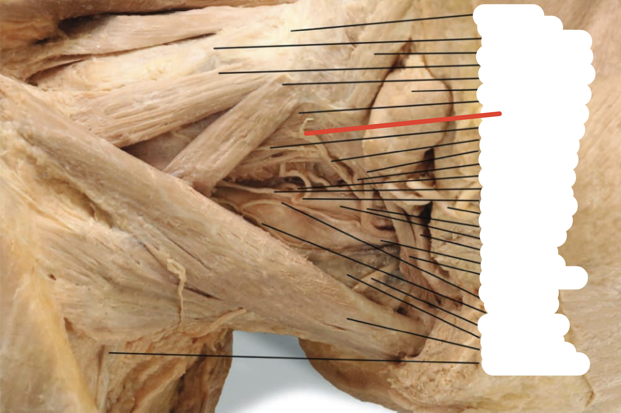 Identify the structure (red line)
