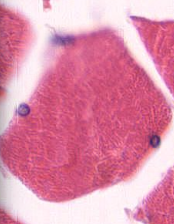 <p>What muscle cell is this and how can you tell? (Transverse section)</p>