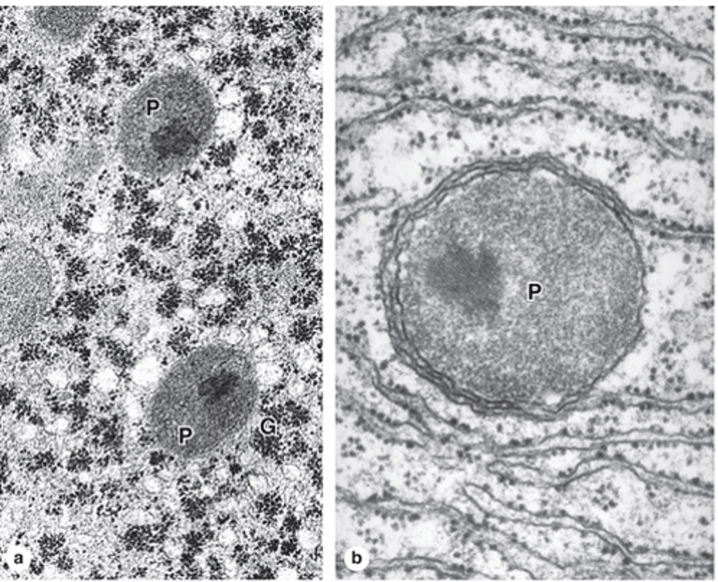 <p>What is the shape and structure of peroxisomes?</p>