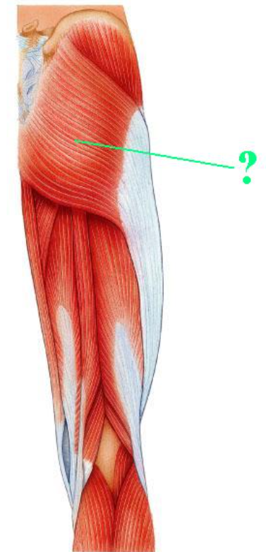 <p><span>Identify the indicated muscle.</span></p>