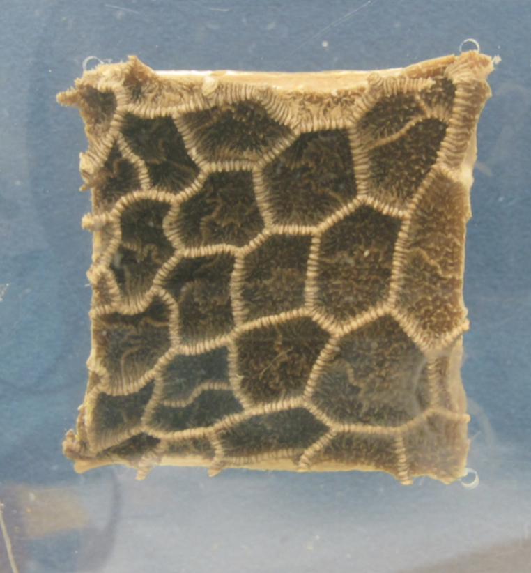 <p><span><span>Which part of the ruminant stomach is shown in this picture?</span></span></p>