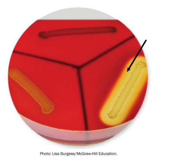 <p><span><span>In this image, the arrow points to a region of the medium where bacterial cells have secreted _____.</span></span></p>