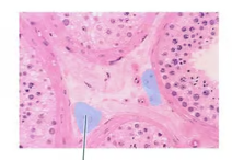 <p><span>Identify the highlighted structures inside the male testis.</span></p>