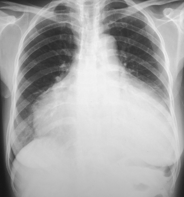 <p>Describe the abnormality demonstrated.</p>