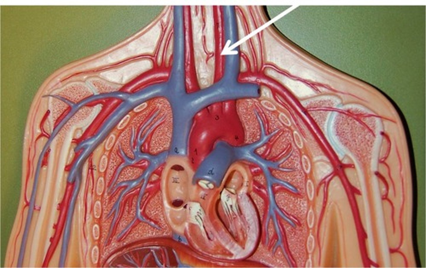 <p>Name the blood vessel.</p>