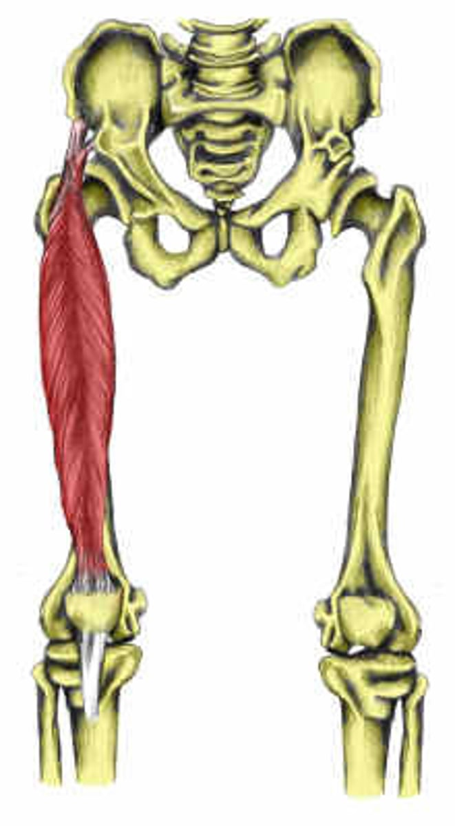<p>1. AIIS</p><p>2. illium (superior to acetabulum)</p>
