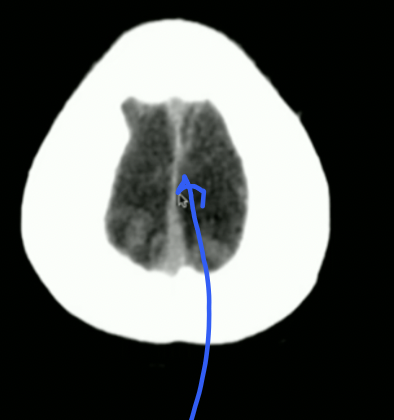 <p>What is the arrow pointing to?</p>