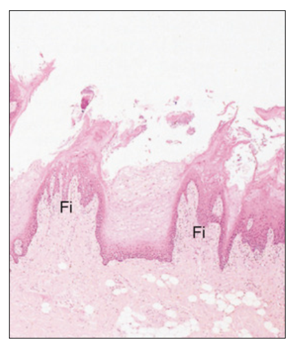<p>Describe Filiform Papillae and its function </p>