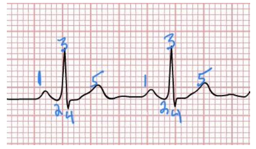 <p>what happens at 4-5</p>