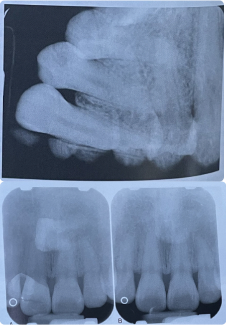 term image