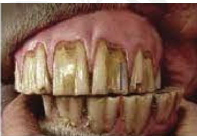 <p>what type of excursion</p>