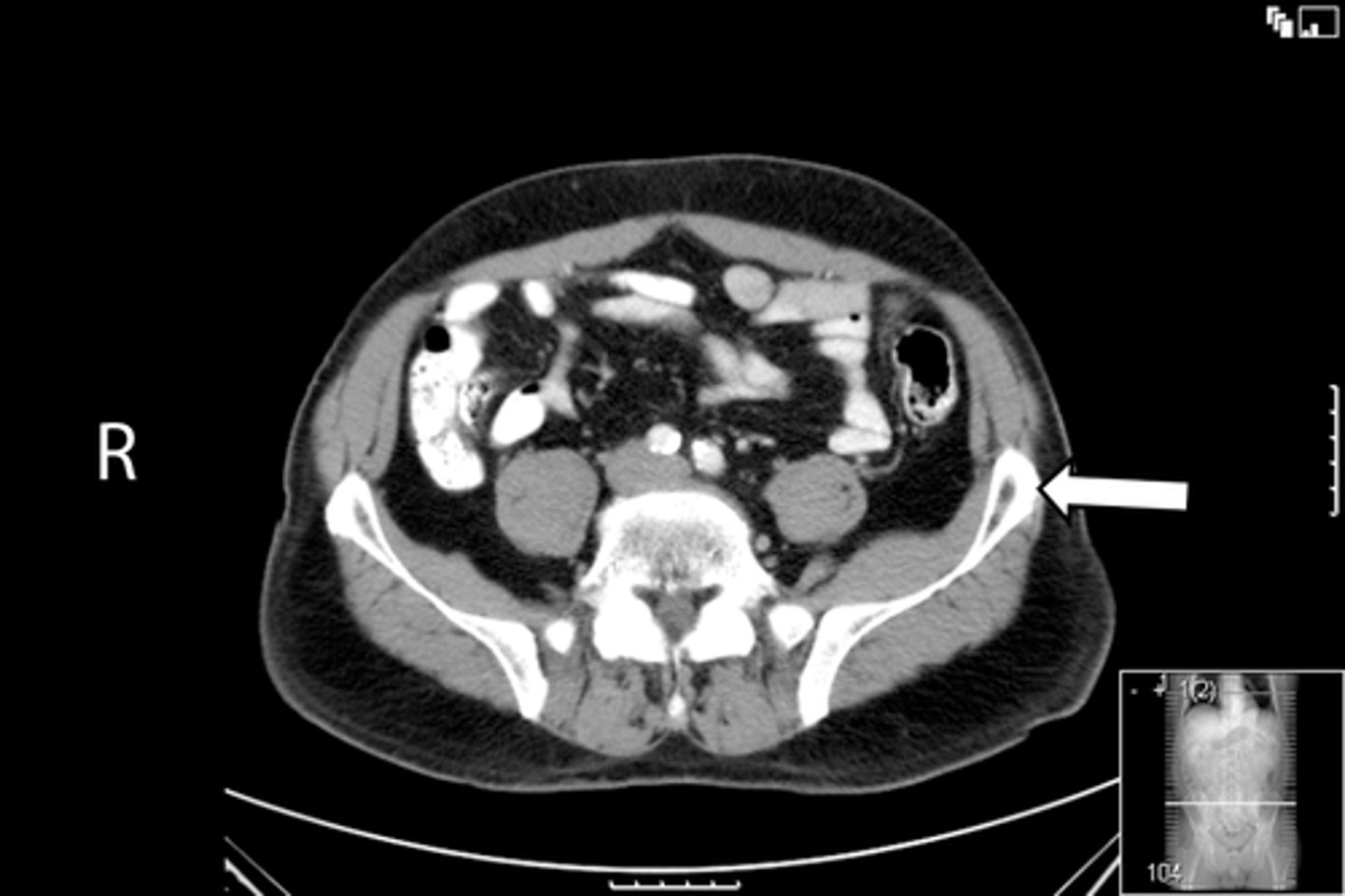 <p>What is indicated in the image?</p>