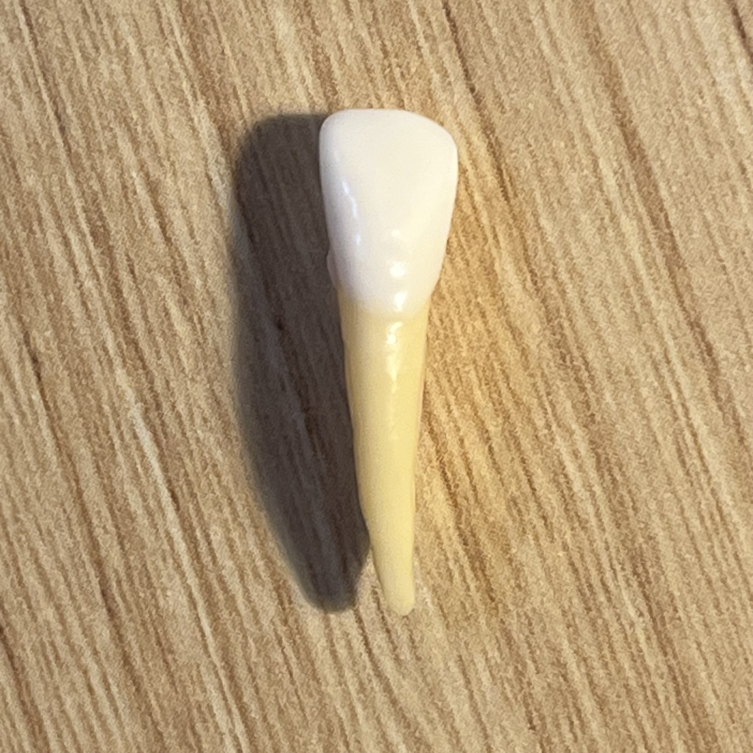 <p>What tooth is this (with view)?</p>