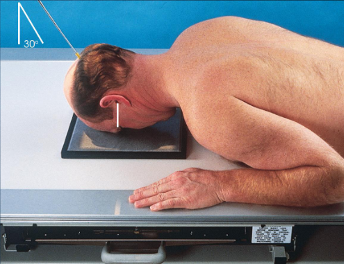 <ul><li><p>patient position:</p><ul><li><p>upright or recumbent</p></li></ul></li><li><p>part position:</p><ul><li><p>rest forehead and nose on IR</p></li><li><p>IR centered ¾ inches distal to nasion</p></li><li><p>adjust head to place MSP and OML perpendicular to IR </p></li></ul></li><li><p>respiration suspended</p></li><li><p>CR:</p><ul><li><p>30 degrees caudad, through center of orbits</p></li></ul></li><li><p>non-grid technique recommended to reduce magnification and eliminate possible artificats</p></li></ul><p></p>