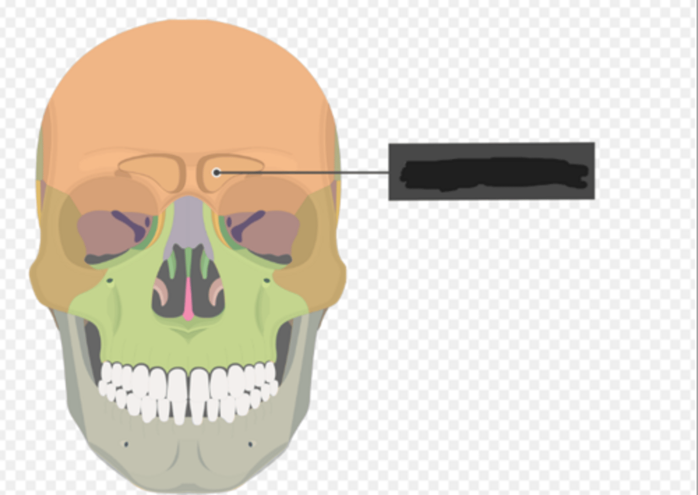 <p>Frontal sinus of the frontal bone</p>