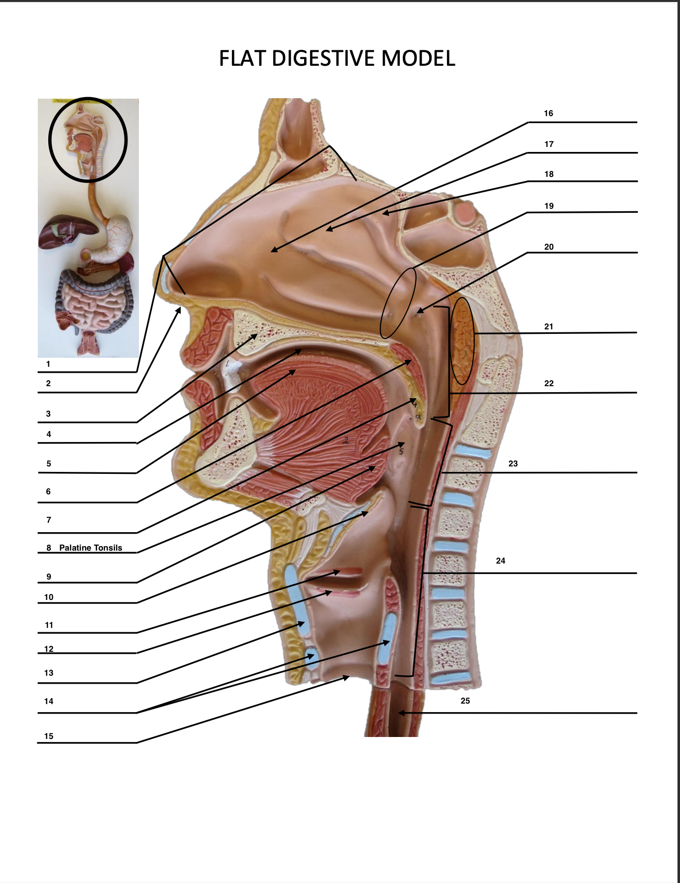 <p>Palatine Tonsils</p>
