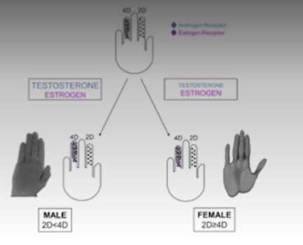 <p>More common in males.</p><p>“Extreme male brain” theory - more systematic, less empathetic brain.</p><p>There seem to be androgen receptor mutation in females with autism.</p><p>Digit ratio suggest excess T exposure in autism.</p>