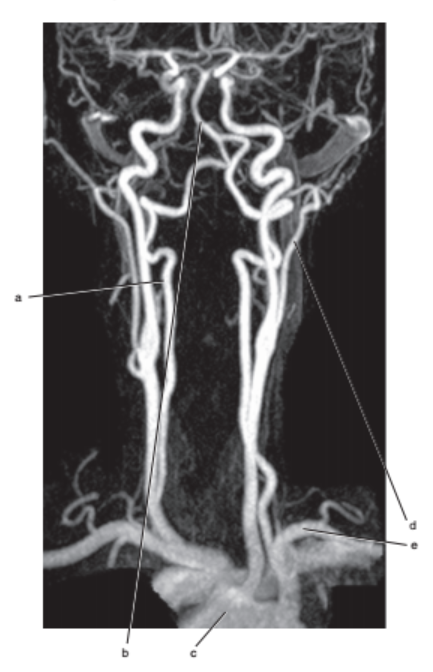 <p>What is letter a ?</p>