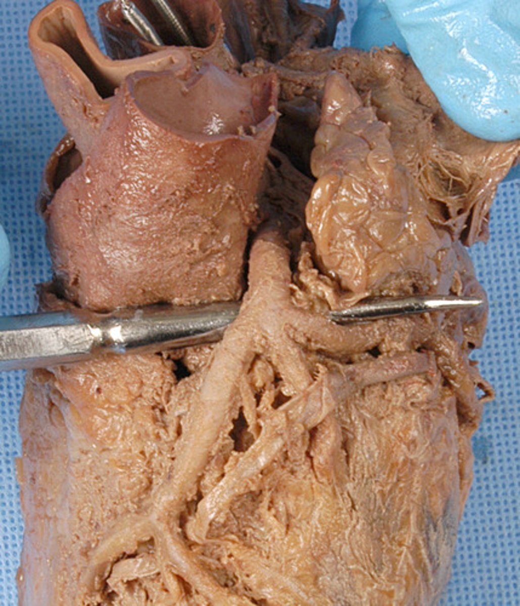 <p>artery</p>