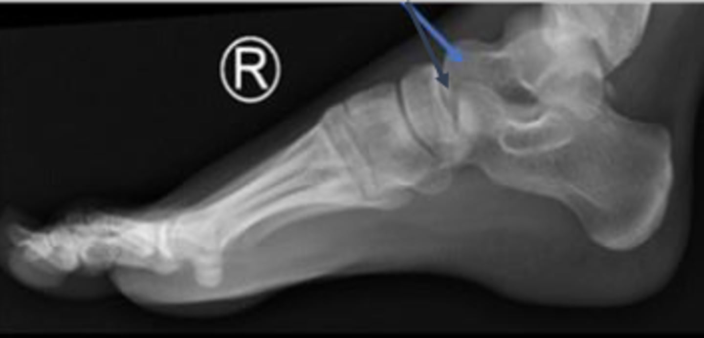 <p>What are the arrows pointing to?</p>