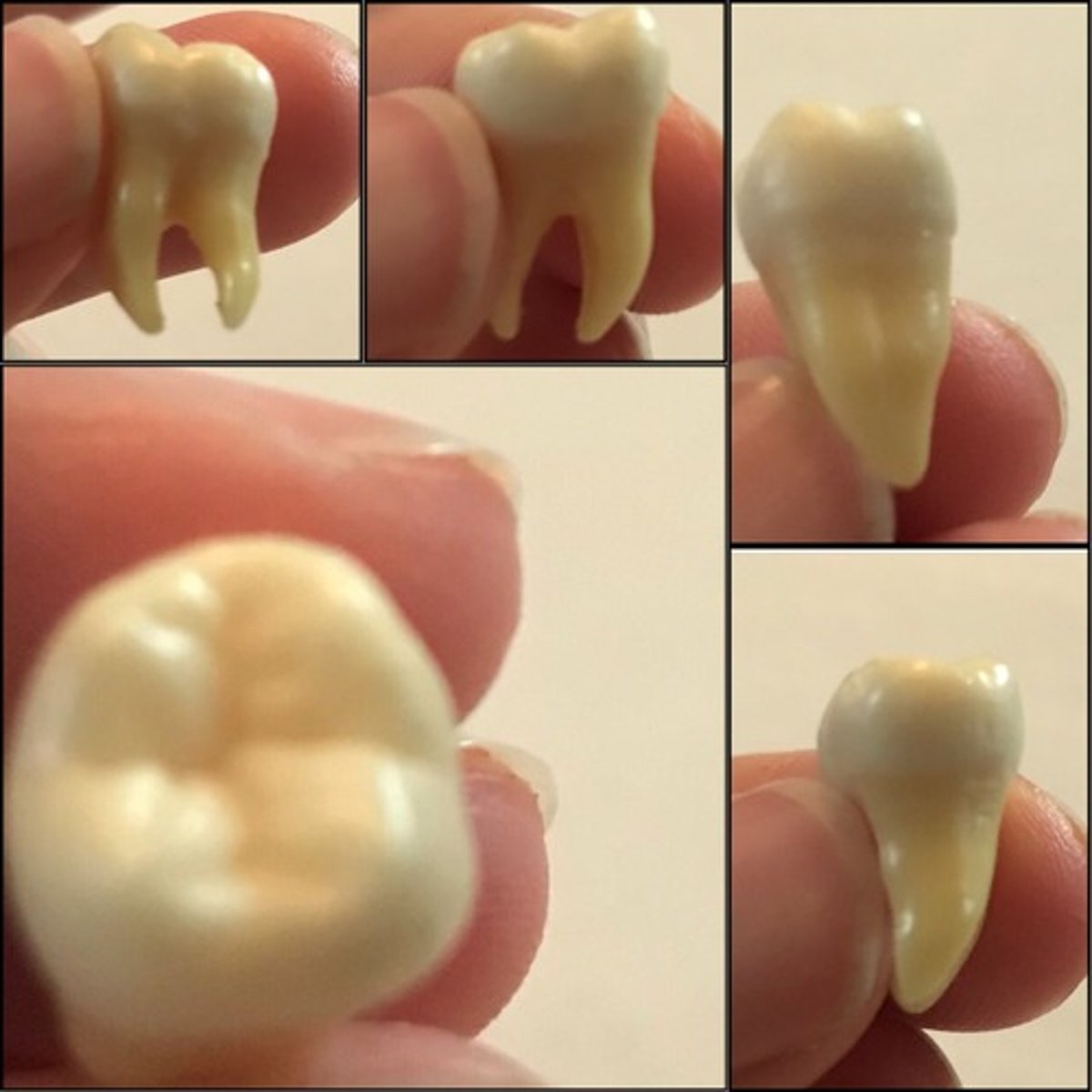 <p>What tooth is this ?</p>