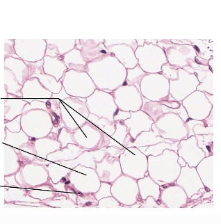 <p>location of adipose tissue</p>