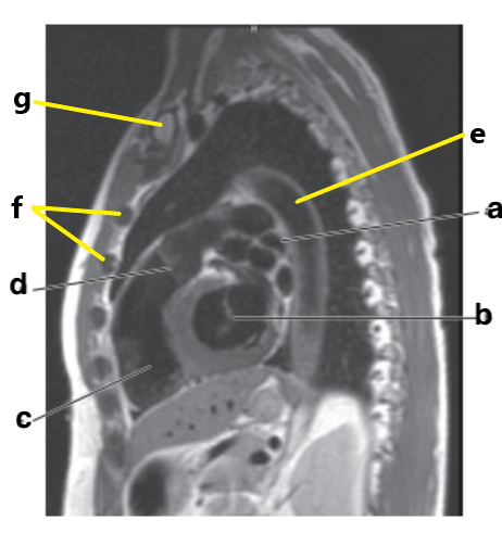 <p>What is letter b?</p>
