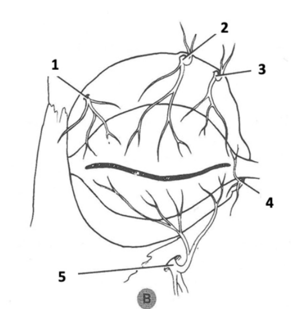 <p>#3</p>