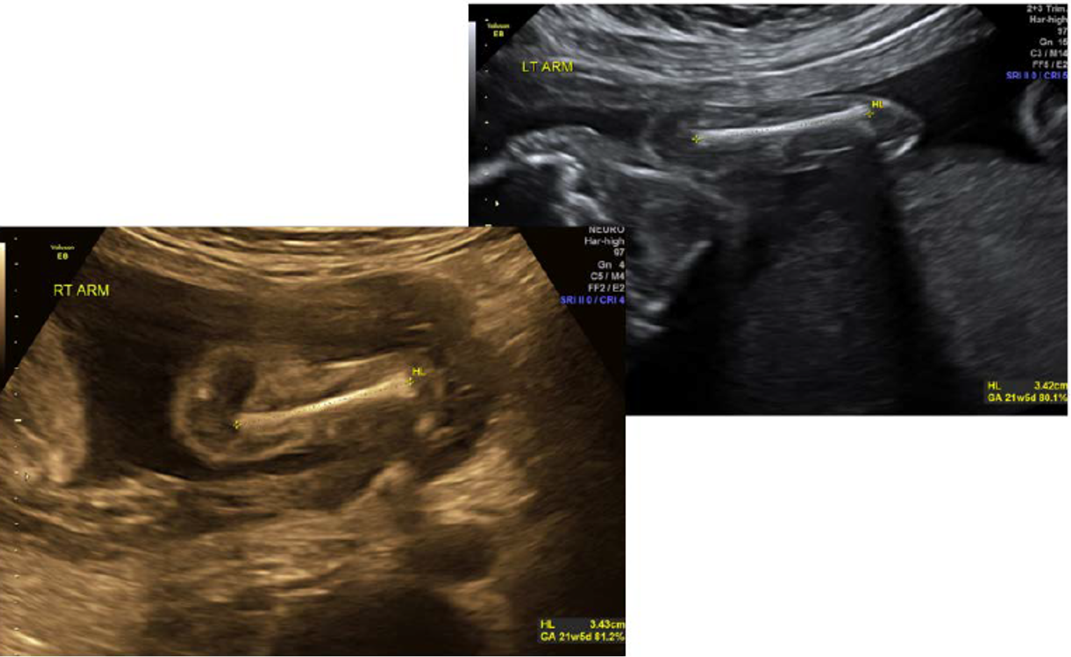<p>make connection with shoulder </p>