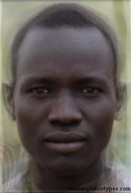 <p>Identify this Phenotype</p>