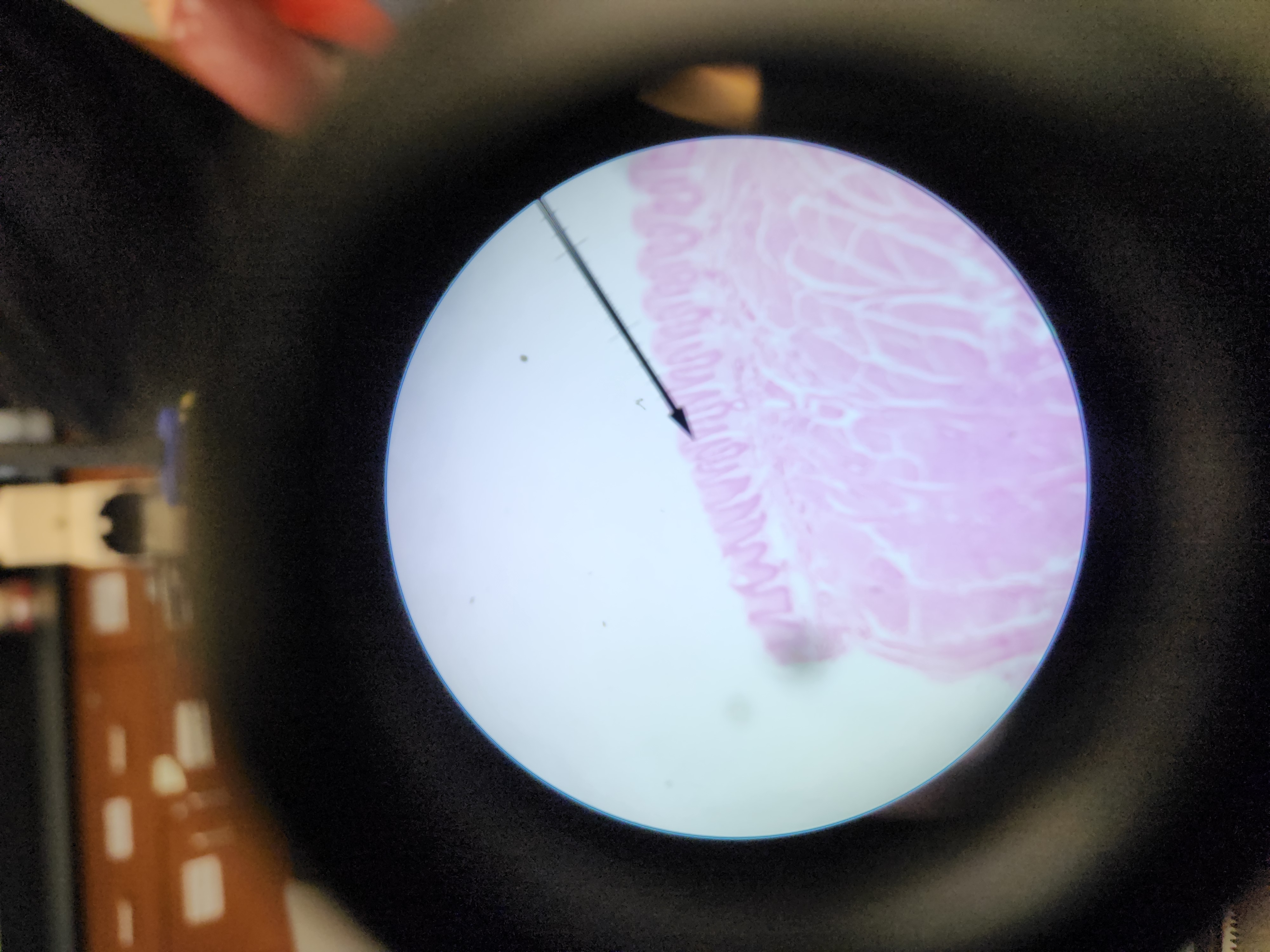 <p>[Histology]</p>