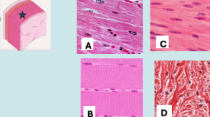 <p>A biopsy is taken from the area indicated by a star on the cross section of the heart shown. Which of the following tissues will be seen on under the microscope?</p>