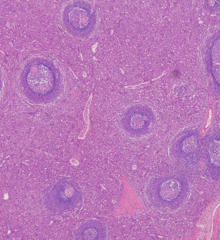 <p>Identify Red vs. White pulp in the spleen</p>