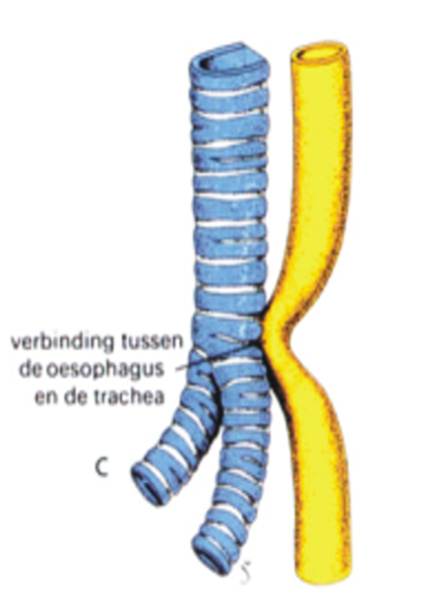 <p>Hoe wordt deze afwijking thv de oesophagus genoemd?</p>
