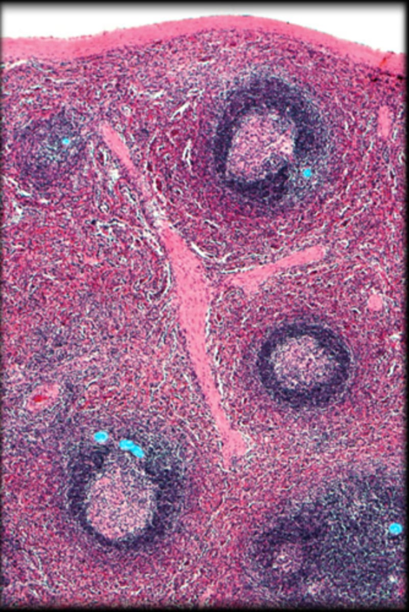 <p>Spleen</p>