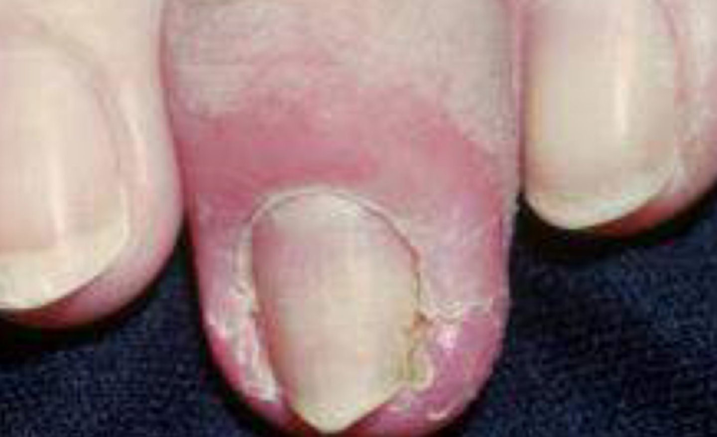 <p>What is the diagnosis?</p>