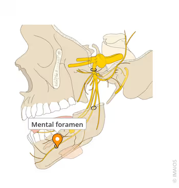 <p>1st and second bicuspid, nerve and blood vessels exit the mental foramen</p><p></p>