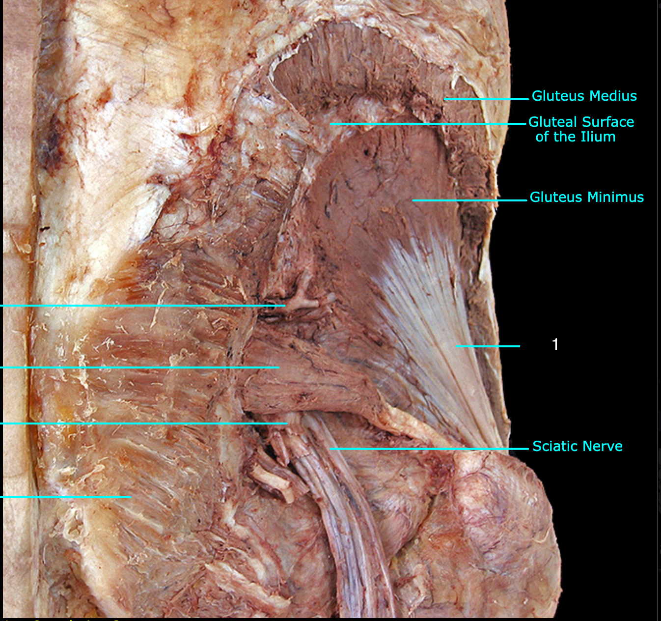 <p>What structure is labeled 1?</p>