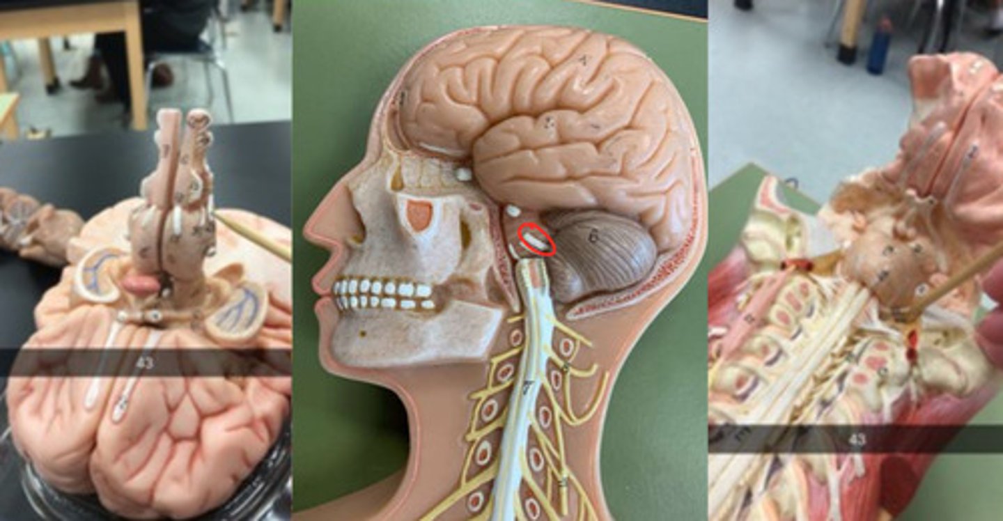 <p>through internal acoustic meatus; inferior to CN VII</p>